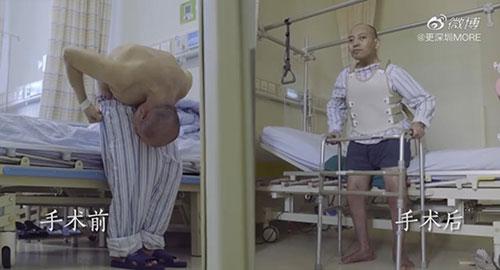 身體被敲斷4次的折疊人出院，打開折疊人生(圖15)